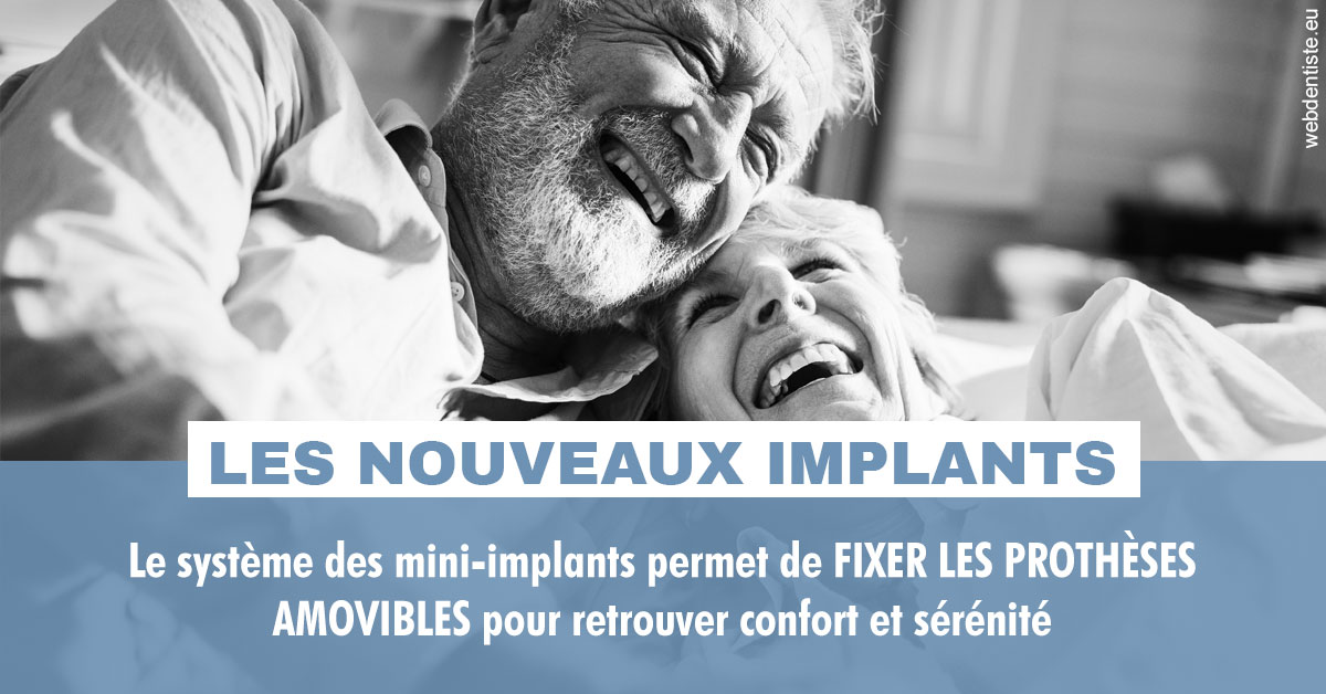 https://dr-chevrier-xavier.chirurgiens-dentistes.fr/Les nouveaux implants 2