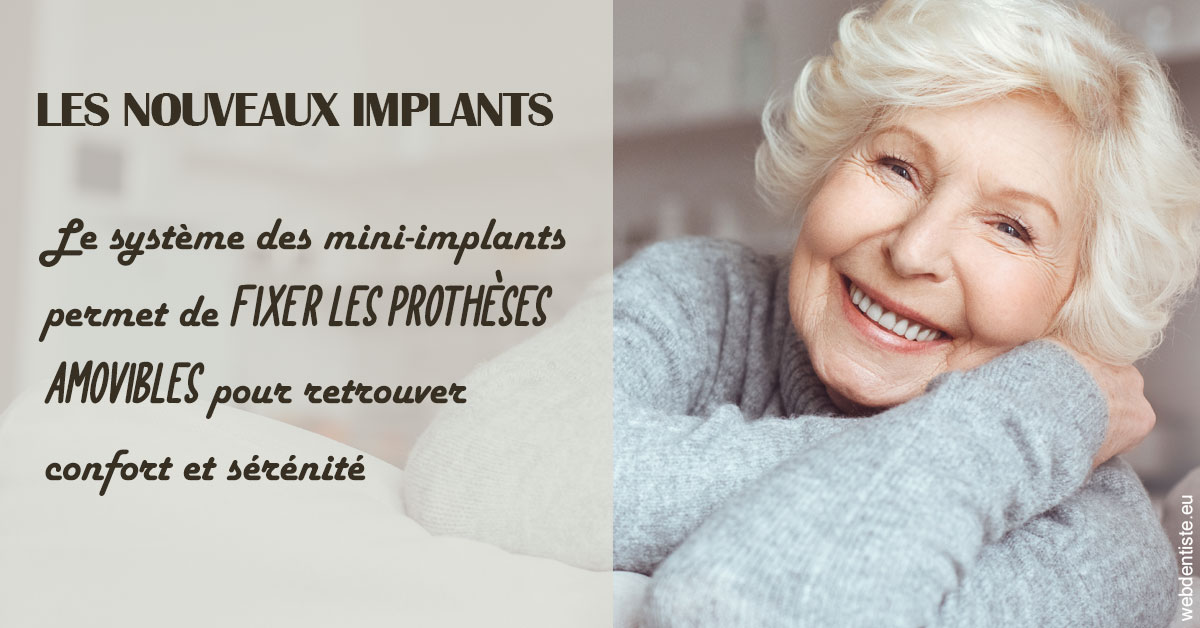 https://dr-chevrier-xavier.chirurgiens-dentistes.fr/Les nouveaux implants 1