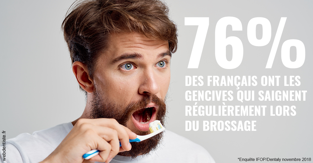 https://dr-chevrier-xavier.chirurgiens-dentistes.fr/76% des Français 2