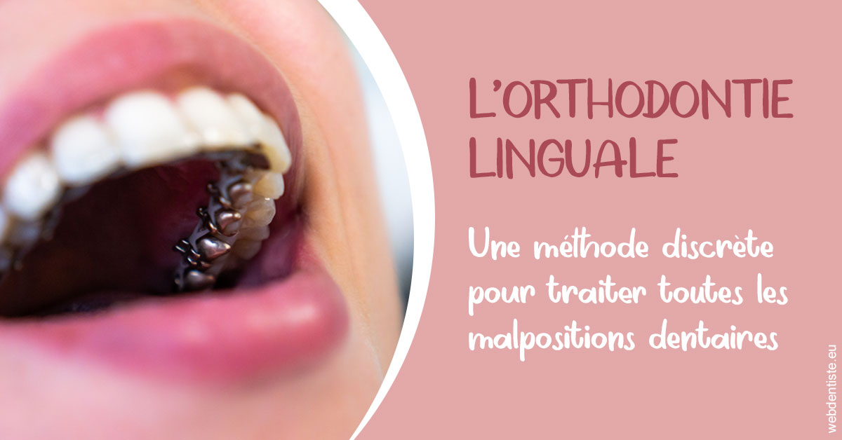 https://dr-chevrier-xavier.chirurgiens-dentistes.fr/L'orthodontie linguale 2
