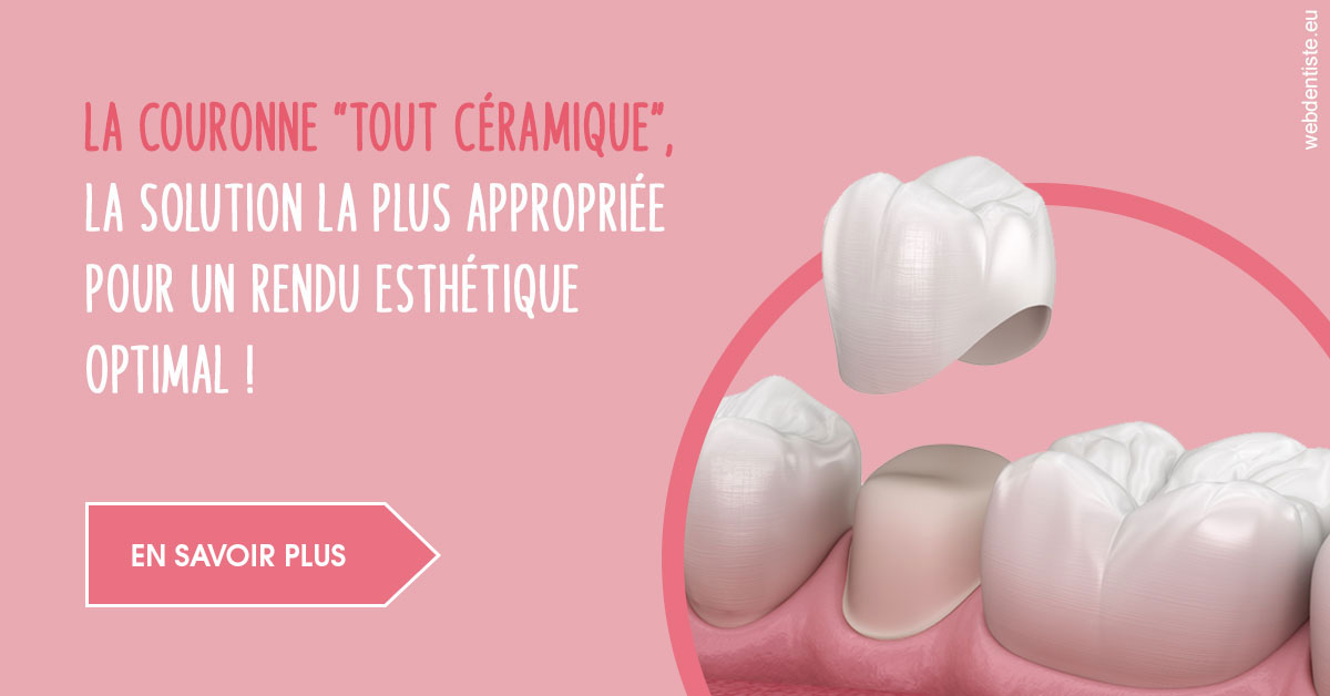 https://dr-chevrier-xavier.chirurgiens-dentistes.fr/La couronne "tout céramique"