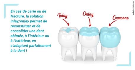 https://dr-chevrier-xavier.chirurgiens-dentistes.fr/L'INLAY ou l'ONLAY