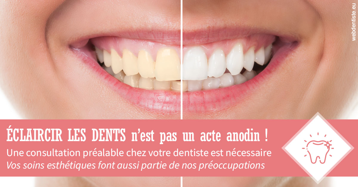 https://dr-chevrier-xavier.chirurgiens-dentistes.fr/Eclaircir les dents 1