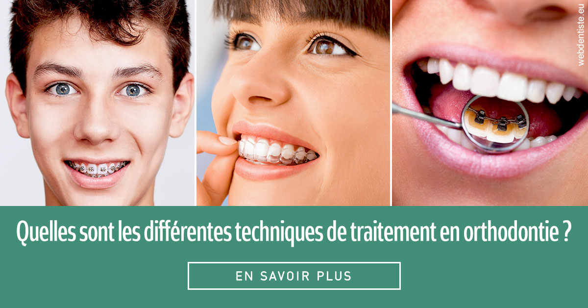 https://dr-chevrier-xavier.chirurgiens-dentistes.fr/Les différentes techniques de traitement 2