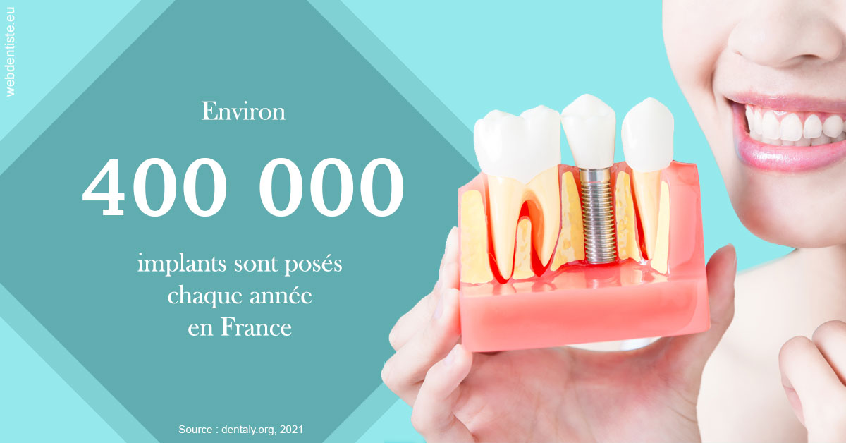 https://dr-chevrier-xavier.chirurgiens-dentistes.fr/Pose d'implants en France 2