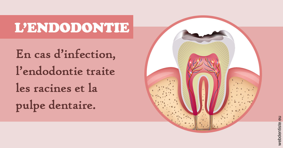 https://dr-chevrier-xavier.chirurgiens-dentistes.fr/L'endodontie 2