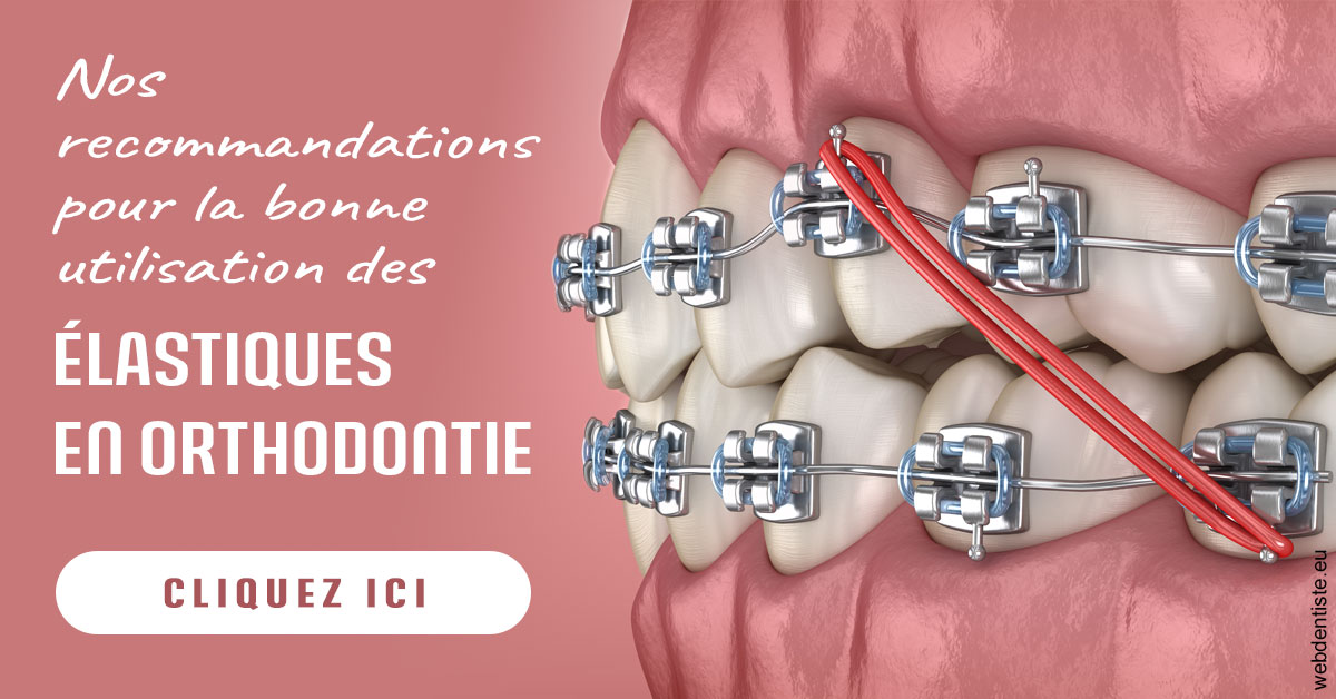 https://dr-chevrier-xavier.chirurgiens-dentistes.fr/Elastiques orthodontie 2